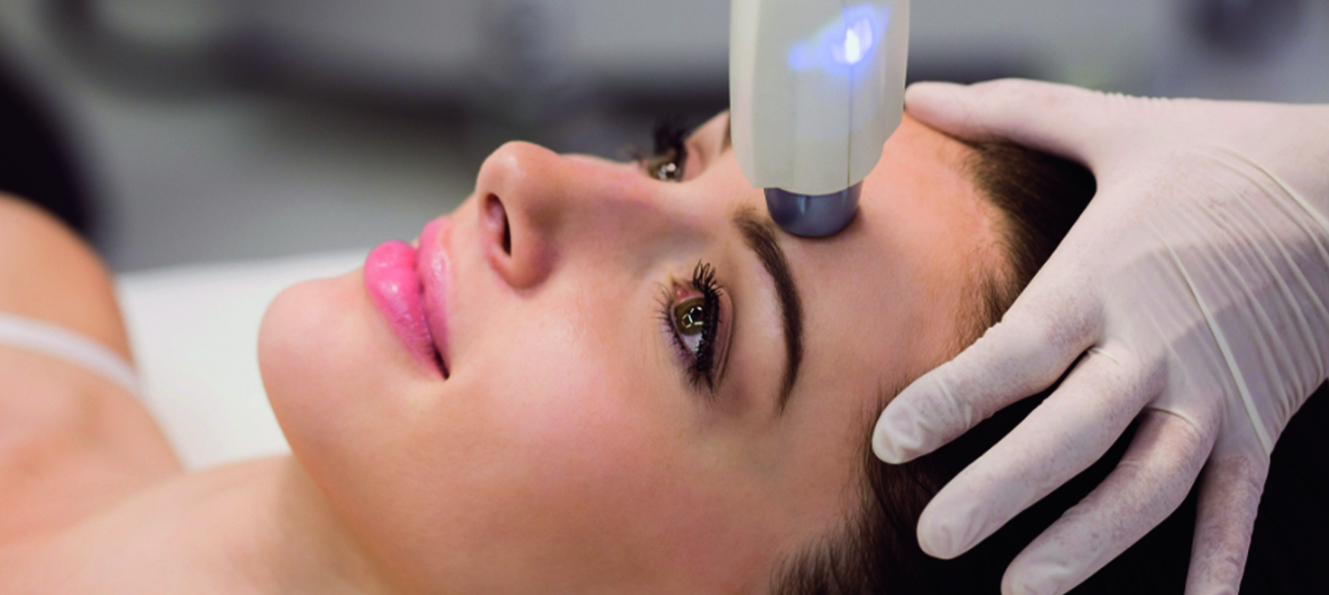 Epilasyon Hizmeti Seviye 4 